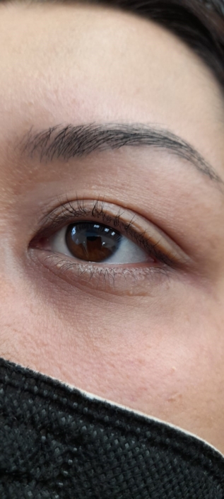 Wimpernlifting